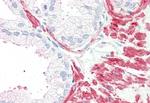 MC5R Antibody in Immunohistochemistry (Paraffin) (IHC (P))