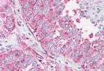 NEK6 Antibody in Immunohistochemistry (Paraffin) (IHC (P))