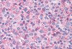 NEK6 Antibody in Immunohistochemistry (Paraffin) (IHC (P))