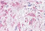 NEK6 Antibody in Immunohistochemistry (Paraffin) (IHC (P))