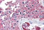 NEK6 Antibody in Immunohistochemistry (Paraffin) (IHC (P))