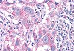 NEK6 Antibody in Immunohistochemistry (Paraffin) (IHC (P))