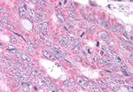 NEK6 Antibody in Immunohistochemistry (Paraffin) (IHC (P))