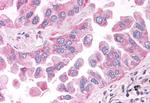 NEK6 Antibody in Immunohistochemistry (Paraffin) (IHC (P))