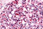 NEK7 Antibody in Immunohistochemistry (Paraffin) (IHC (P))