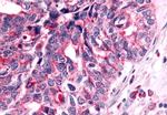 NEK7 Antibody in Immunohistochemistry (Paraffin) (IHC (P))