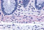 TACR2 Antibody in Immunohistochemistry (Paraffin) (IHC (P))