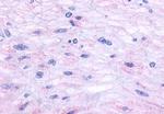 TACR2 Antibody in Immunohistochemistry (Paraffin) (IHC (P))