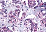 TACR2 Antibody in Immunohistochemistry (Paraffin) (IHC (P))