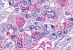 TACR2 Antibody in Immunohistochemistry (Paraffin) (IHC (P))