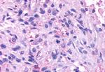 NPBWR1 Antibody in Immunohistochemistry (Paraffin) (IHC (P))