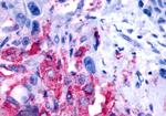 NPBWR2 Antibody in Immunohistochemistry (Paraffin) (IHC (P))