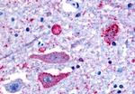 NPBWR2 Antibody in Immunohistochemistry (Paraffin) (IHC (P))