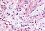 NOR-1 Antibody in Immunohistochemistry (Paraffin) (IHC (P))