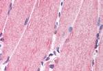 NRG1 Antibody in Immunohistochemistry (Paraffin) (IHC (P))