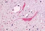 NTSR1 Antibody in Immunohistochemistry (Paraffin) (IHC (P))