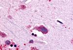 NTSR1 Antibody in Immunohistochemistry (Paraffin) (IHC (P))