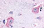 Opsin 3 Antibody in Immunohistochemistry (Paraffin) (IHC (P))