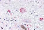 OR10R2 Antibody in Immunohistochemistry (Paraffin) (IHC (P))