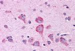 OXGR1 Antibody in Immunohistochemistry (Paraffin) (IHC (P))