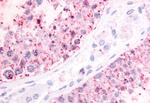 P2Y1 Antibody in Immunohistochemistry (Paraffin) (IHC (P))