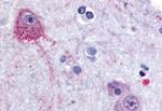 PCSK6 Antibody in Immunohistochemistry (Paraffin) (IHC (P))