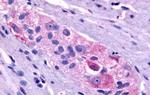 Prokineticin Receptor 1 Antibody in Immunohistochemistry (Paraffin) (IHC (P))