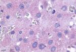 PTGFR Antibody in Immunohistochemistry (Paraffin) (IHC (P))