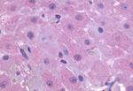 PTGFR Antibody in Immunohistochemistry (Paraffin) (IHC (P))