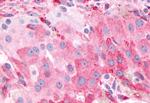 PTGFR Antibody in Immunohistochemistry (Paraffin) (IHC (P))