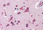 QSOX2 Antibody in Immunohistochemistry (Paraffin) (IHC (P))