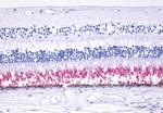 Rhodopsin Antibody in Immunohistochemistry (Paraffin) (IHC (P))