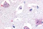 RORB Antibody in Immunohistochemistry (Paraffin) (IHC (P))