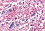 RORB Antibody in Immunohistochemistry (Paraffin) (IHC (P))