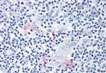 ROR gamma Antibody in Immunohistochemistry (Paraffin) (IHC (P))