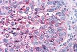 ROR gamma Antibody in Immunohistochemistry (Paraffin) (IHC (P))