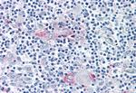 ROR gamma Antibody in Immunohistochemistry (Paraffin) (IHC (P))