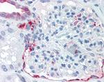 ZIP14 Antibody in Immunohistochemistry (Paraffin) (IHC (P))