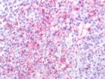 SSTR2 Antibody in Immunohistochemistry (Paraffin) (IHC (P))