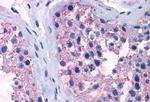 TAS1R1 Antibody in Immunohistochemistry (Paraffin) (IHC (P))