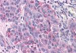 TAS1R3 Antibody in Immunohistochemistry (Paraffin) (IHC (P))