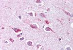 TLL2 Antibody in Immunohistochemistry (Paraffin) (IHC (P))