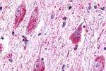 TPRA1 Antibody in Immunohistochemistry (Paraffin) (IHC (P))