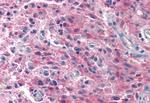 TRPM4 Antibody in Immunohistochemistry (Paraffin) (IHC (P))