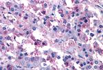 VIPR1 Antibody in Immunohistochemistry (Paraffin) (IHC (P))