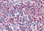 VPAC2 Antibody in Immunohistochemistry (Paraffin) (IHC (P))