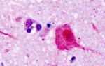 VN1R1 Antibody in Immunohistochemistry (Paraffin) (IHC (P))