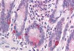 WNT1 Antibody in Immunohistochemistry (Paraffin) (IHC (P))