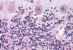 WNT2 Antibody in Immunohistochemistry (Paraffin) (IHC (P))