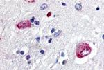 WNT8A Antibody in Immunohistochemistry (Paraffin) (IHC (P))